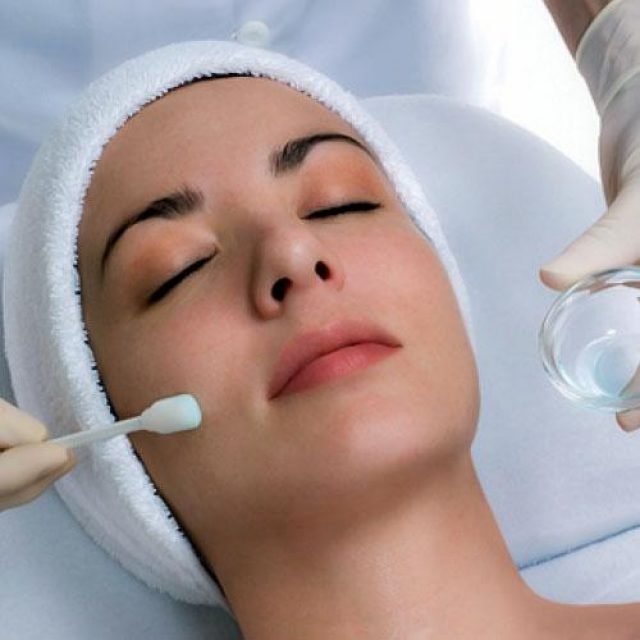 Chemical Peel